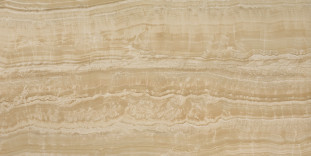 Atlas Concorde Marvel Edge Gold Onyx Lapp 75x150